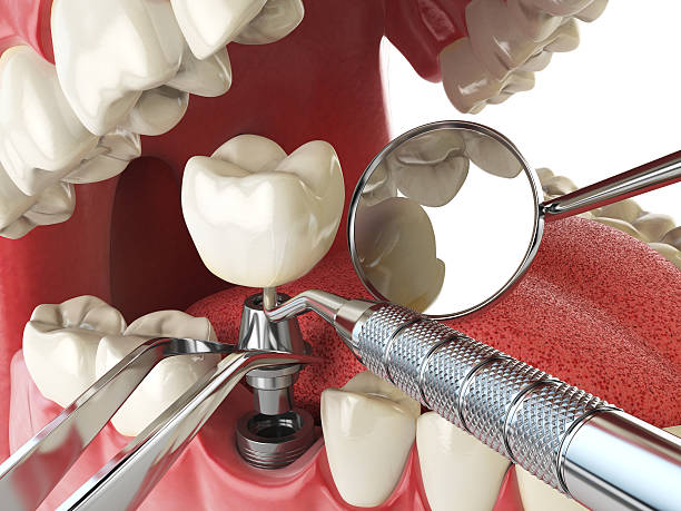 Best Emergency Treatment for Oral Infections in Farmington, MN